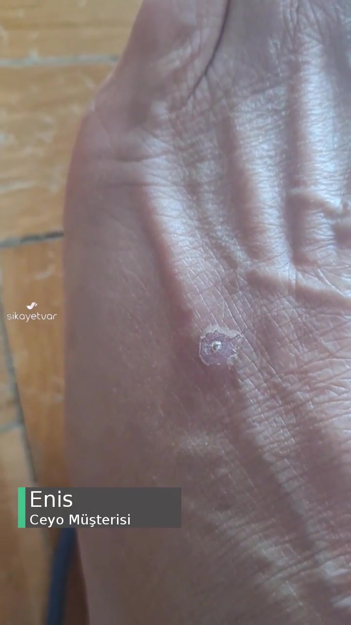 Kusurlu Ceyo Terlikleri, Kampanyada videonun kapak resmi