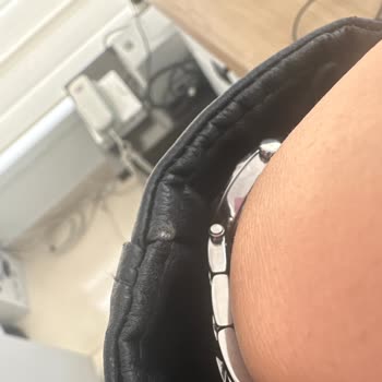 Zara Deri Ceket Kısa Sürede Deforme Oldu, Mağaza Yardımcı Olmadı