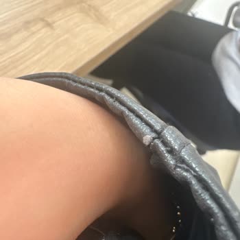 Zara Deri Ceket Kısa Sürede Deforme Oldu, Mağaza Yardımcı Olmadı