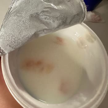 Aldığım Sütaş Ayranın İçinden Küf Ve Yabancı Cisim Çıktı