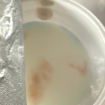 Aldığım Sütaş Ayranın İçinden Küf Ve Yabancı Cisim Çıktı