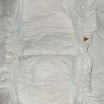 Molfix 5 Numara Bebek Bezinde Tekrarlayan Kalite Sorunları Ve Sağlık Riski