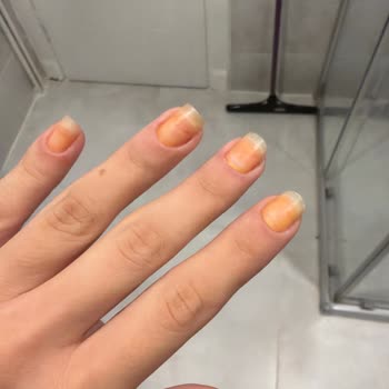 Flormar Oje Tırnaklarımı Sararttı, Masraflarım Karşılanmalı!