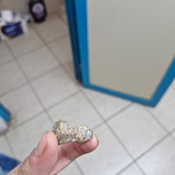 Fropie Omega 3 Mix İçinden Kıl Ve Vida Çıkması, Müşteri Hizmetlerine Ulaşılamaması