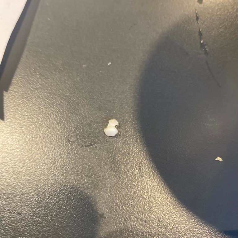 Çıtır Tavuk Burgerde Kemik Çıktı Çalışanlar Çözüm Sunmadı