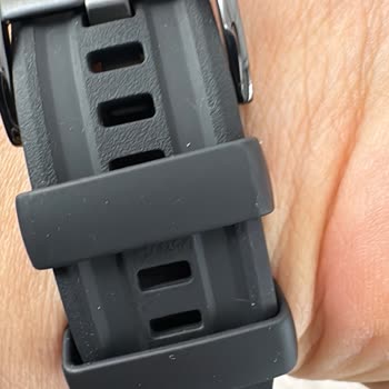 Huawei GT 6 Pro Akıllı Saat Kordonunda Kronik Soyulma Ve Yetersiz Servis Desteği