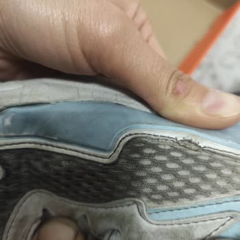 Kısa Sürede Açılan Ayakkabıya Garanti Desteği Sağlanmadı