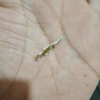 A101’den Aldığım Ürünlerde Yabancı Madde Ve İlgisiz Müşteri Hizmetleri