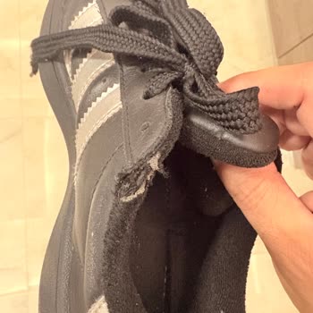 Adidas Ayakkabının İç Astarı Kısa Sürede Deforme Oldu, Garanti Kabul Edilmedi