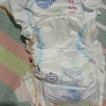 Molfix 6 Numara Bezde Sarı Madde Ve Yapışma Sorunu Mağduriyeti