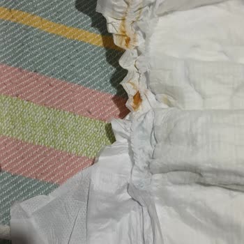 Molfix 6 Numara Bezde Sarı Madde Ve Yapışma Sorunu Mağduriyeti