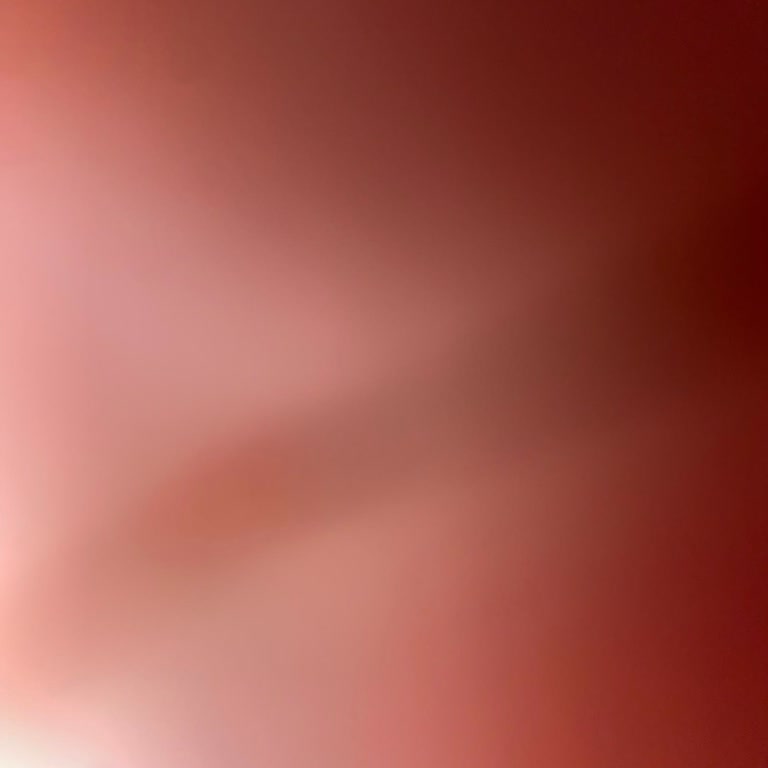 Doğal Gaz Dönüşümü Nedeniyle Kalorifer Sistemimiz Zarar Gördü, Mağduriyetimiz Giderilmiyor