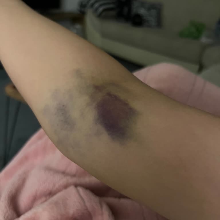 Acil Serviste Hemşire Kaynaklı Ağrı Ve Doku Hasarı Şikayeti