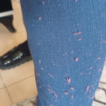 Özdilek Prestige Battaniye Tüylenme Sorunu Ve İade Talebine Çözüm Sunulmaması