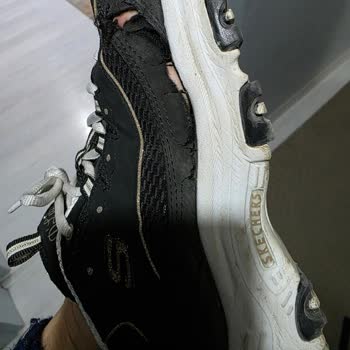 Aldığım Skechers Ayakkabı Hızla Deforme Oldu, Firma Çözüm Sunmuyor