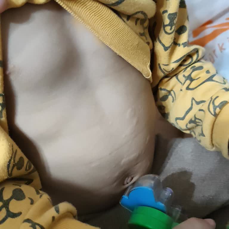 Acvison Kidofin Sambu Multivitamin Alerji Yaptı