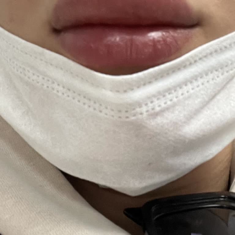 Yasaklı Madde İçeren BB Krem Sağlığımı Tehdit Etti