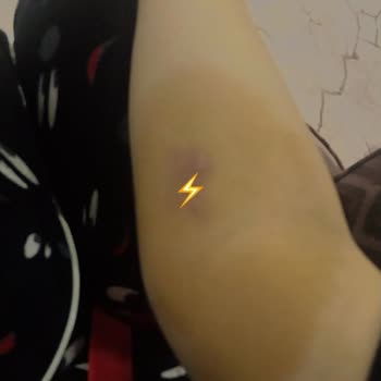 Yanlış Serum Uygulaması Sonrası Kolumda Kalıcı İz Oluştu, Mağduriyetim Giderilmedi