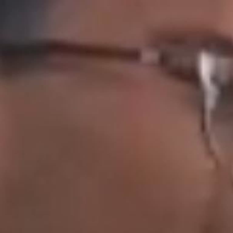 Slazenger Gözlükte Sürekli Sorun Ve Müşteri Hizmetlerinden Çözüm Alamama