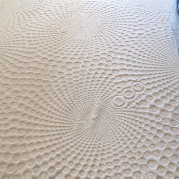 Yatakta Dengesizlik Ve Ağrıya Rağmen Servis Talebime Dönüş Yapılmıyor