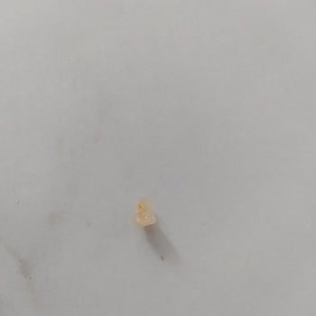 Helvadan Çıkan Taş Çocuğumun Dişini Kırdı: Mağduriyetimin Giderilmesini İstiyorum