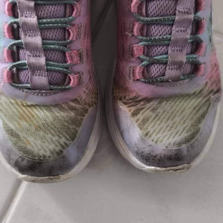 5 Ayda Bozulan Skechers Ayakkabıya Ret Cevabı Ve İletişimsizlik Mağduriyeti