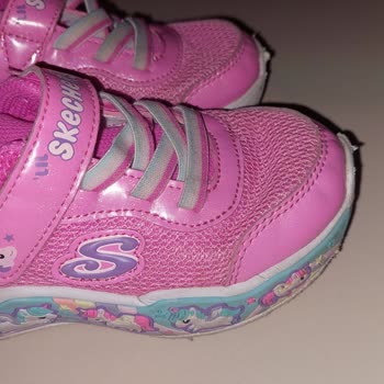 Kısa Sürede Deforme Olan Skechers Bebek Ayakkabısında Değişim Reddi