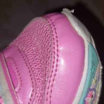 Kısa Sürede Deforme Olan Skechers Bebek Ayakkabısında Değişim Reddi