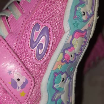 Kısa Sürede Deforme Olan Skechers Bebek Ayakkabısında Değişim Reddi