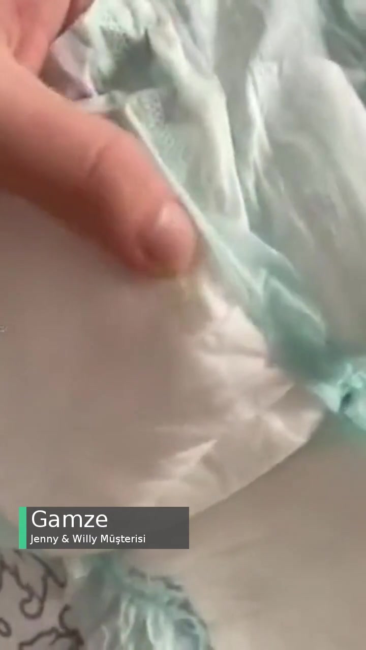 Jenny & Willy Bebek Bezinde Silikon Olması videonun kapak resmi