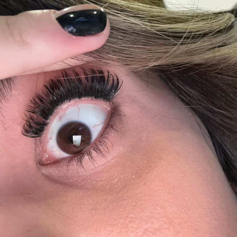 İpek Kirpik İşlemi Sonrası Yaşanan Görme Problemi Ve Yetersiz Müşteri Desteği