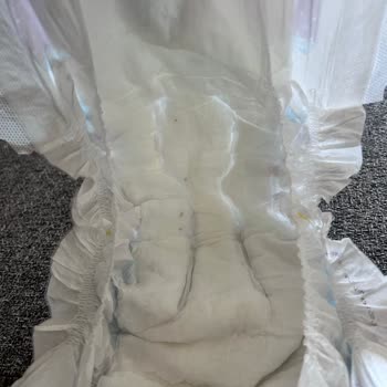 Molfix Bebek Bezlerinde Siyah Noktalar Endişelendiriyor