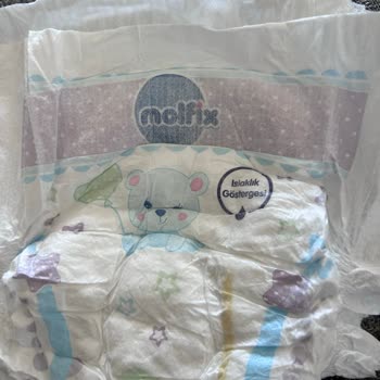 Molfix Bebek Bezlerinde Siyah Noktalar Endişelendiriyor