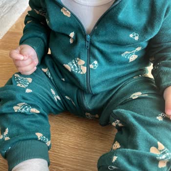 Koton'dan Aldığım Tulumun Boyası Akıyor, Çocuğumun Cildi Etkilendi