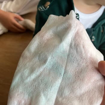 Koton'dan Aldığım Tulumun Boyası Akıyor, Çocuğumun Cildi Etkilendi