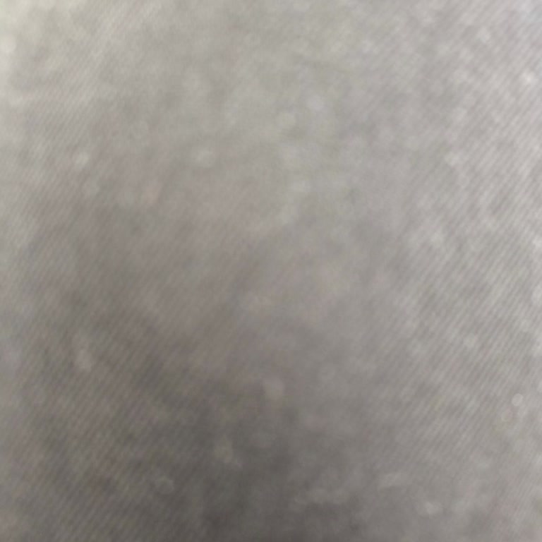 Yanık Tavuklar Ve Yetersiz Müşteri İlgisi Nedeniyle Hayal Kırıklığı