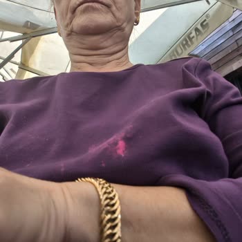 Çamaşır Suyu Lekesi Nedeniyle Kıyafetim Zarar Gördü