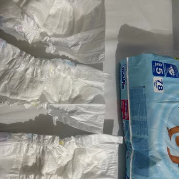 Molfix 5 Numara Bebek Bezlerinde Tekrarlayan Yan Cırt Cırt Sorunu