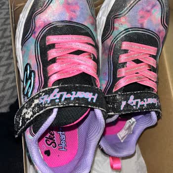 Skechers Ayakkabıda Kısa Sürede Renk Ve Taban Soyulması Sorunu