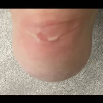 Sorunlu Ayakkabı Ve Yetersiz İnceleme Sonucu Nedeniyle Mağduriyet