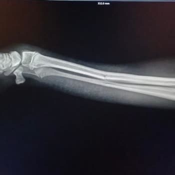 AVM'nin Puset Zorunluluğu Nedeniyle Köpeğimin Yaralanması