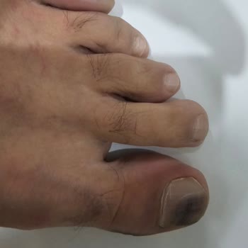 FLO Online’dan Alınan Ayakkabıda Renk Verme Ve Potluk Sorunu, Yetersiz İnceleme