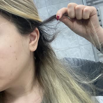 Saç Boyama İşlemi Sonrası Saçlarım Yandı, Ücret İadesi Ve Tazminat Talebim Karşılanmadı