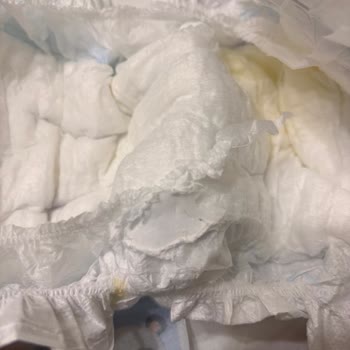 Molfix Bebek Bezinde Sert Parça Nedeniyle Oluşan Tahriş Endişesi