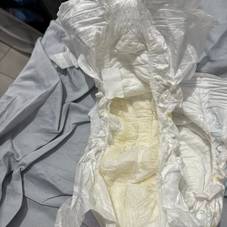 Aldığım Molfix Bebek Bezlerinde Sürekli Sızdırma Ve Orijinallik Şüphesi Yaşadım