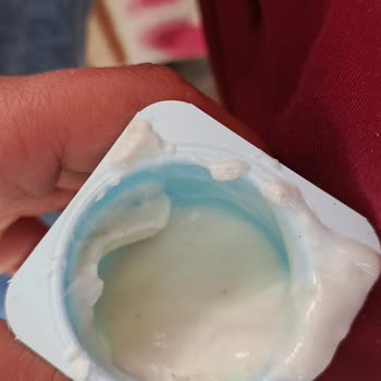 Üründe Kurt Çıkması Nedeniyle Acil Açıklama Bekliyorum