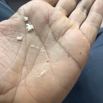 Bebek Mamasında Böcek Kanadı Şoku: Sağlık Ve Güvenlik Endişesi