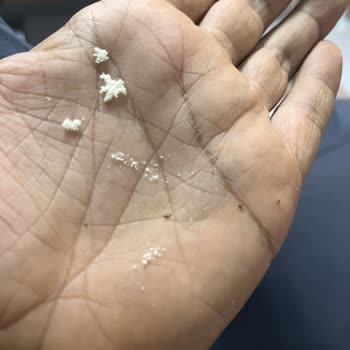 Bebek Mamasında Böcek Kanadı Şoku: Sağlık Ve Güvenlik Endişesi