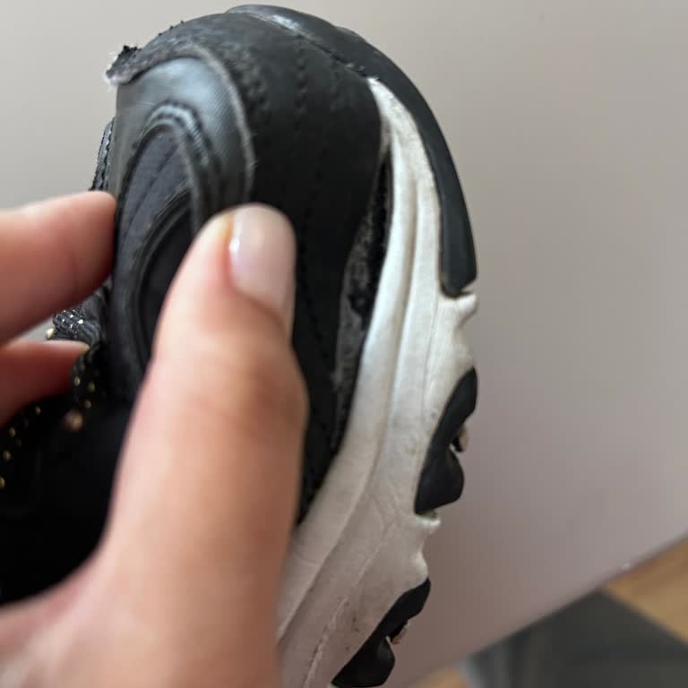 Skechers D’Lites Defect: How to Get a Refund or Replacement