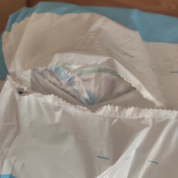 Bebek Bezinde Yoğun Kimyasal Koku Ve Yırtık Paket Sorunu: Sağlık Endişesi Ve Çözüm Talebi